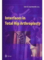 Interfaces in Total Hip Arthroplasty