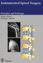 Instrumented Spinal Surgery: Principles and Technique