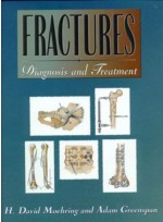 Fractures: Diagnosis and Treatment
