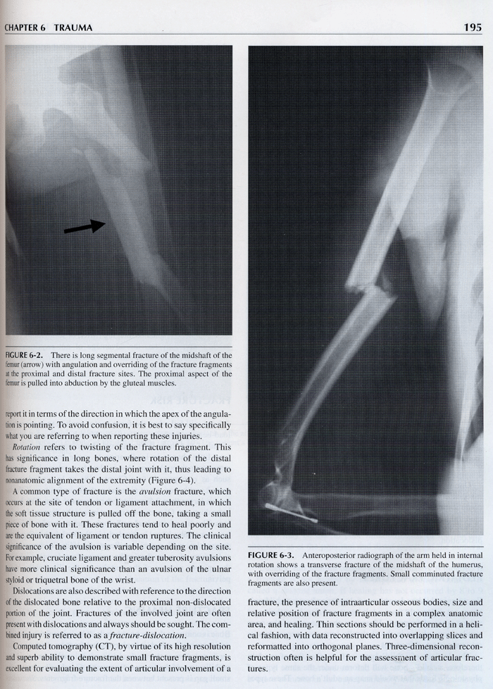 Diagnostic Musculoskeletal Radiology