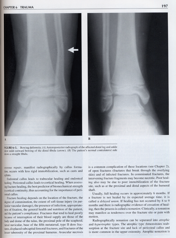 Diagnostic Musculoskeletal Radiology