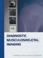 Diagnostic Musculoskeletal Radiology