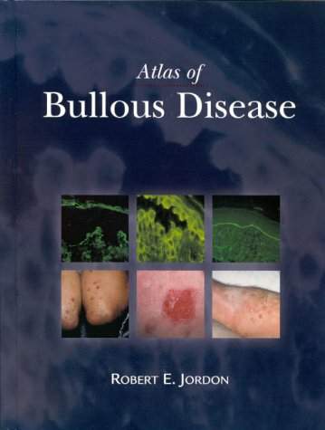 Atlas of Bullous Diseases