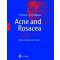 Acne and Rosacea