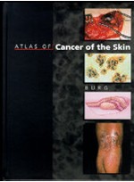 Atlas of Cancer of the Skin