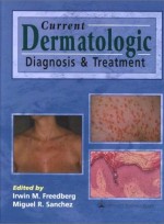 Current Dermatologic Diagnosis and Treatment