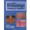 Current Dermatologic Diagnosis and Treatment