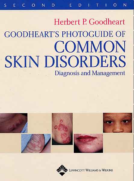 Goodheart\'s Photoguide of Common Skin Disorders: Diagnosis and Management