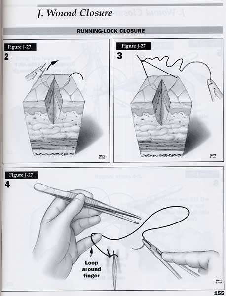 수술 술기 Atlas : Essential Surgical Skills & CD-ROM