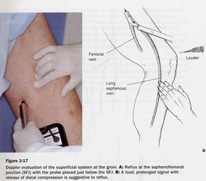 Manual of Sclerotherapy