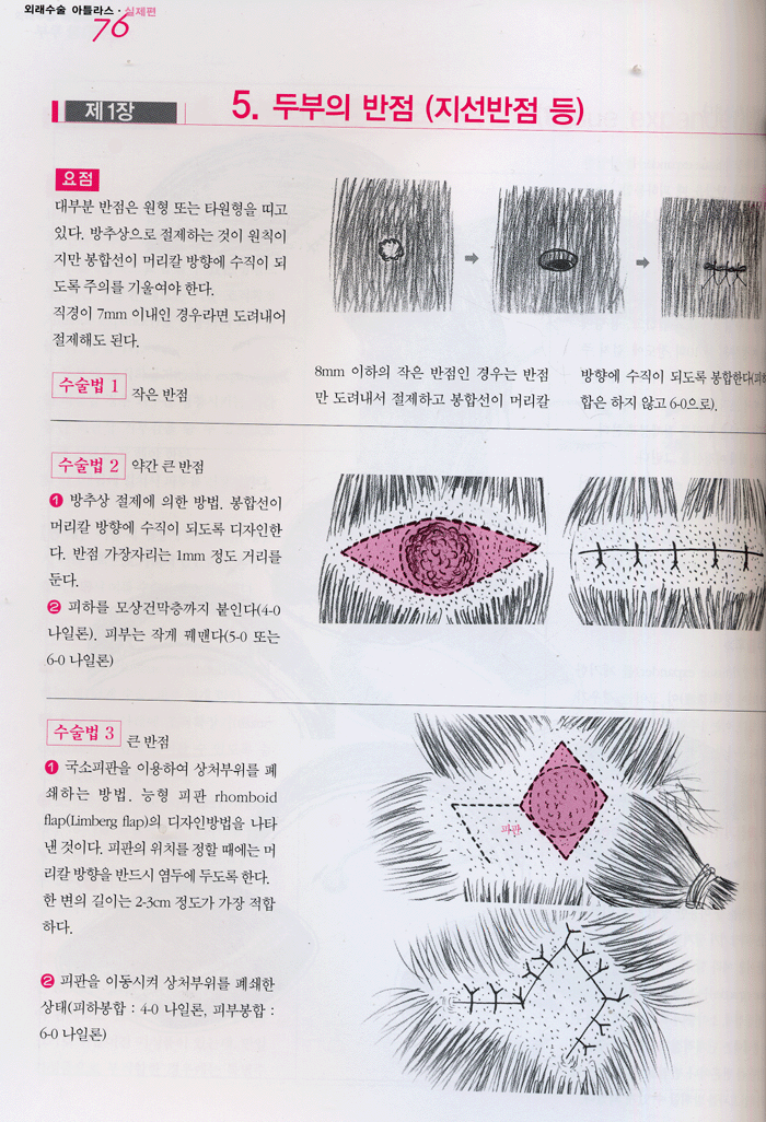 외래수술 ATLAS [일반의 및 성형외과 전공의를 위한]