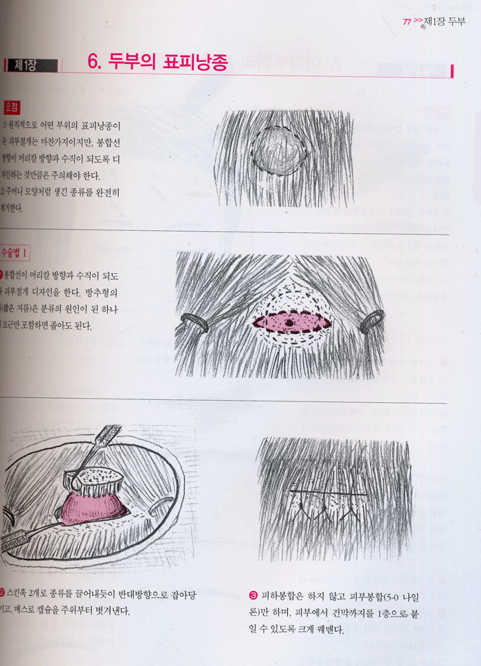 외래수술 ATLAS [일반의 및 성형외과 전공의를 위한]