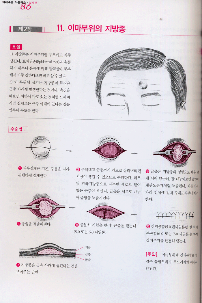 외래수술 ATLAS [일반의 및 성형외과 전공의를 위한]