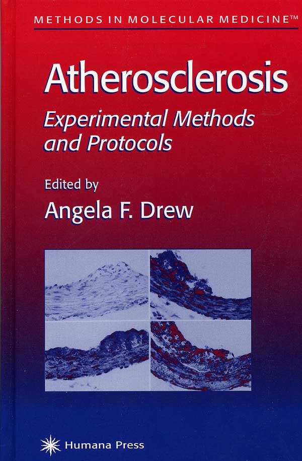 Atherosclerosis: Experimental Methods and Protocols