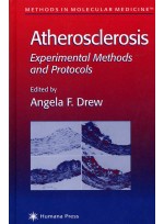 Atherosclerosis: Experimental Methods and Protocols