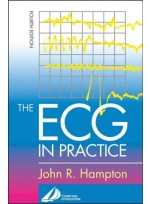 The Ecg in Practice 4th