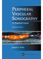 Peripheral Vascular Sonography : A Practical Guide