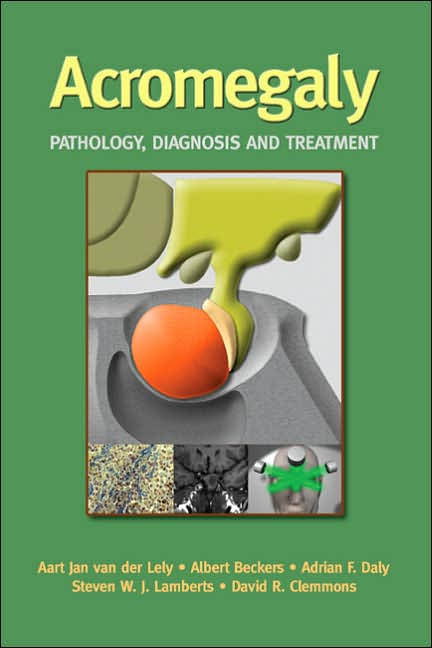 Acromegaly:Pathology Diagnosis & Treatment