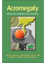 Acromegaly:Pathology Diagnosis & Treatment