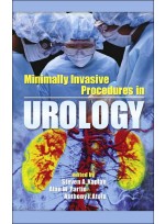 Minimally Invasive Procedures In Urology