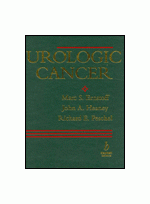 Urologic Cancer