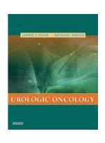 Urologic Oncology