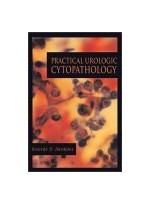 Practical Urologic Cytopathology