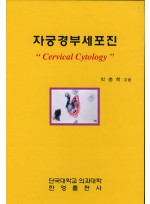 자궁경부세포진 : Cervical Cytology