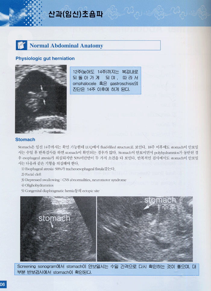 산과 (임신) 초음파