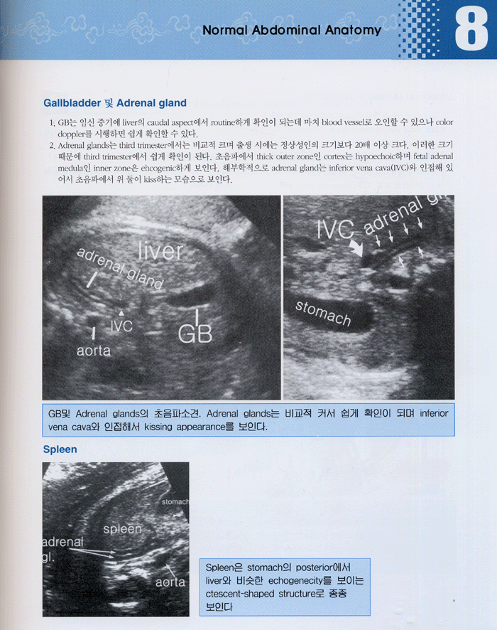 산과 (임신) 초음파