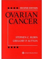 Ovarian Cancer