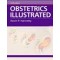 Obstetrics Illustrated