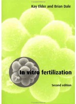 In Vitro Fertilization