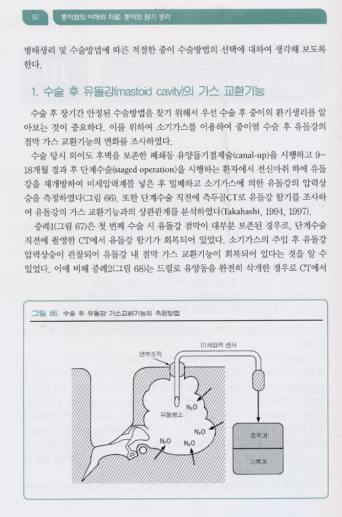 중이염의 이해와 치료