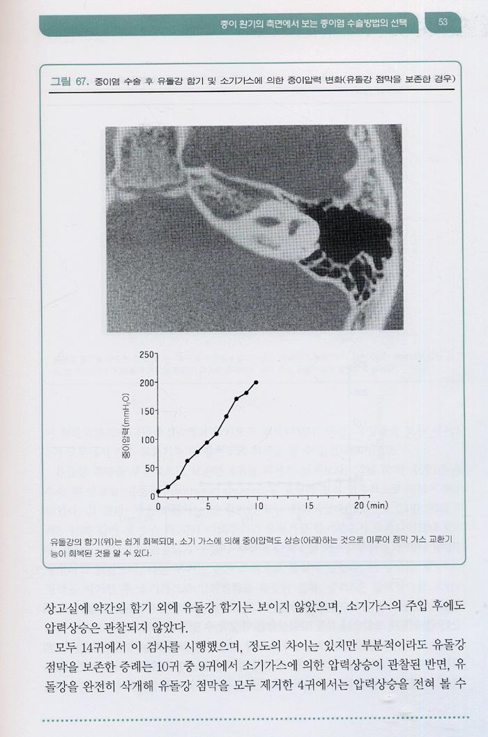 중이염의 이해와 치료