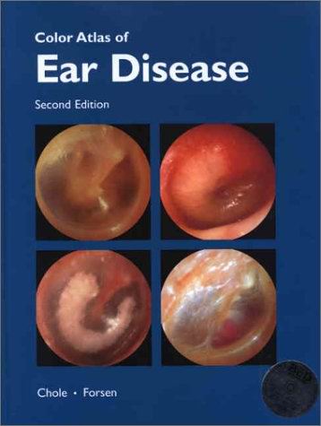 Color Atlas of Ear Disease