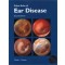 Color Atlas of Ear Disease