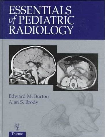 Essentials of Pediatric Radiology