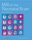 MRI of the Neonatal Brain