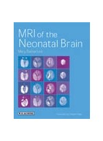 MRI of the Neonatal Brain