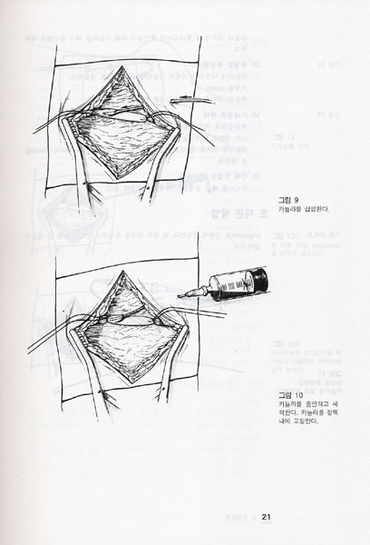 임상실기 아틀라스 Atlas of Bedside Procedures 개정신판