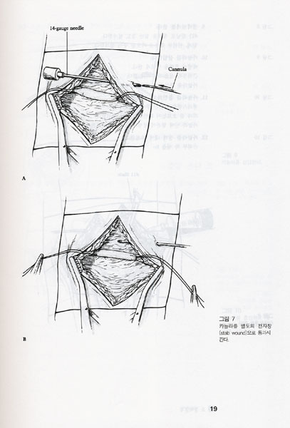 임상실기 아틀라스 Atlas of Bedside Procedures 개정신판