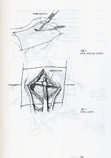 임상실기 아틀라스 Atlas of Bedside Procedures 개정신판