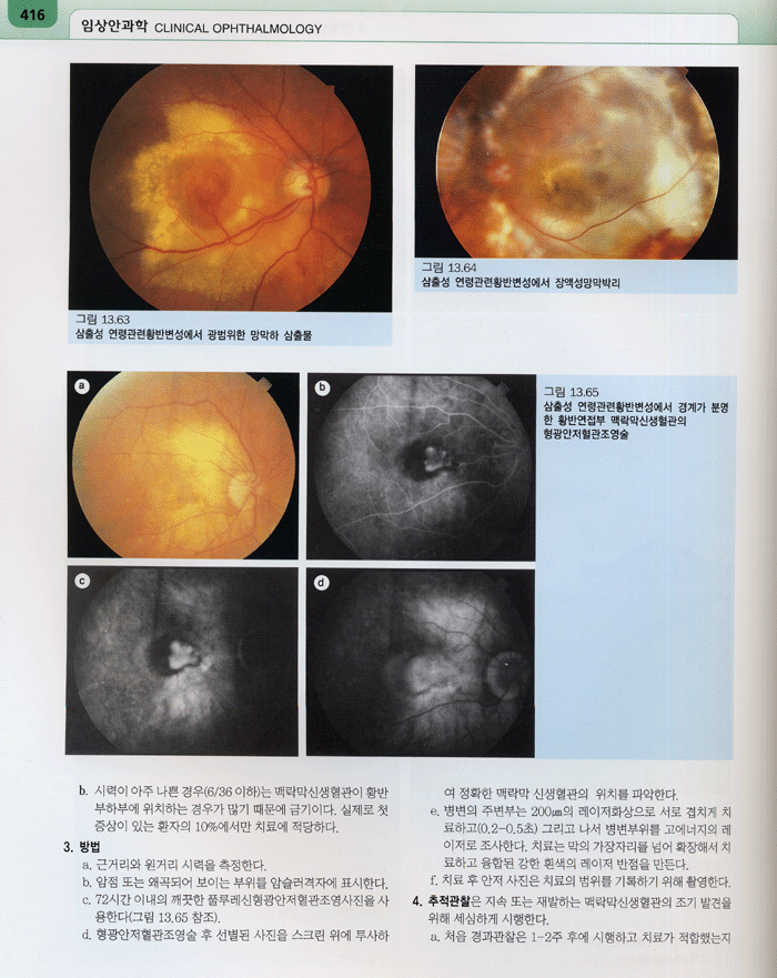 임상안과학 Clinical Ophthalmology 5th 번역서