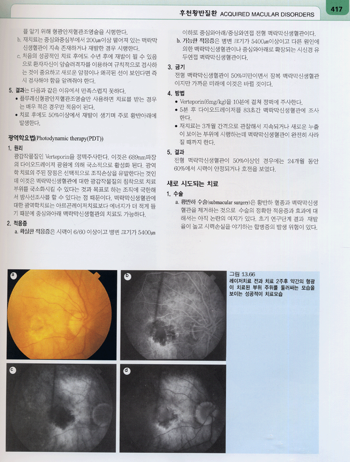 임상안과학 Clinical Ophthalmology 5th 번역서