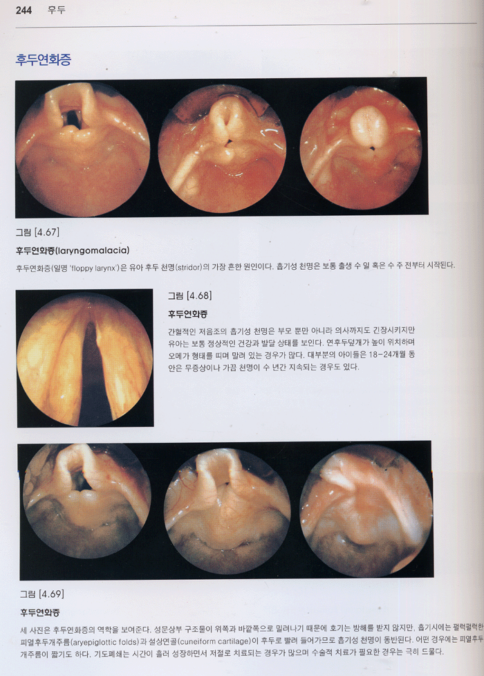 A Color Atlas of Otorhinolaryngology - 사진으로 보는 이비인후과학