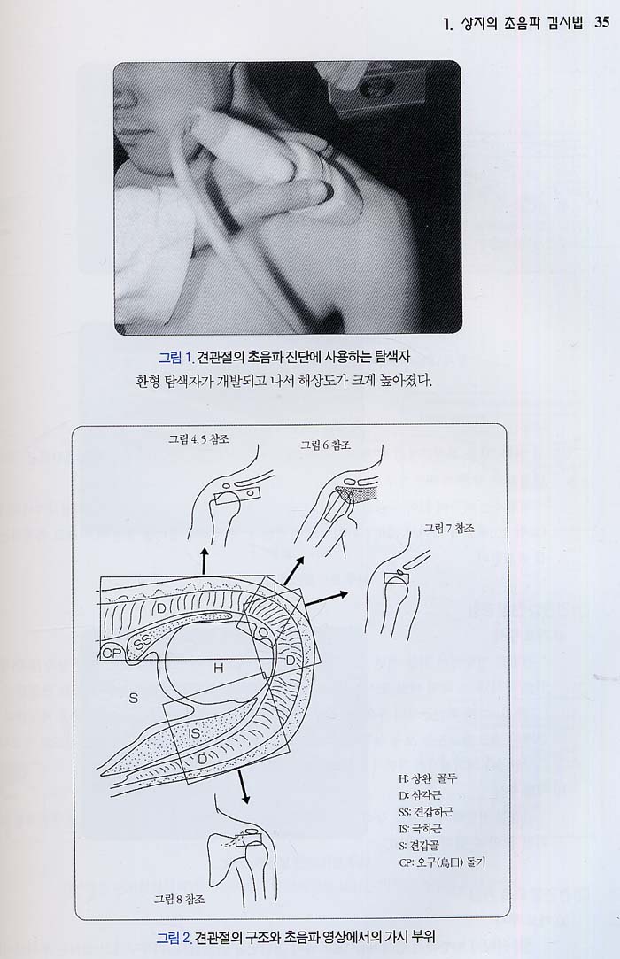 정형외과 초음파 진단 Atlas