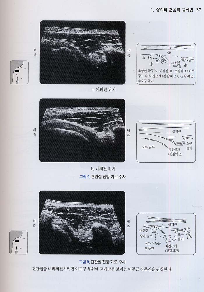 정형외과 초음파 진단 Atlas