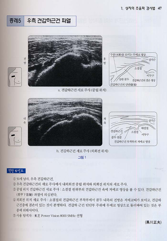 정형외과 초음파 진단 Atlas