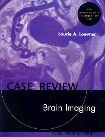 Brain Imaging Case Review